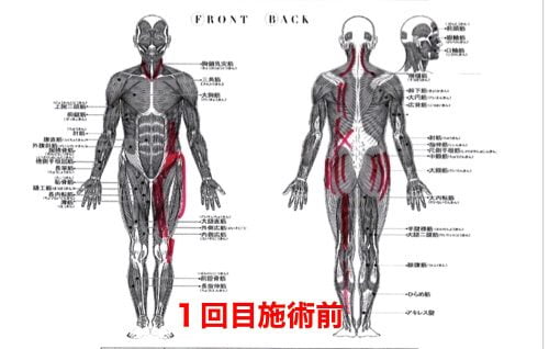 前かがみで腰が痛い方の状態1