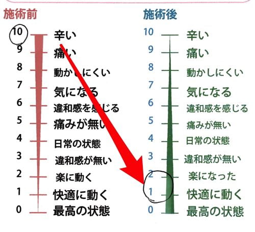 身体全体のコリ_-背中のコリほぐす3