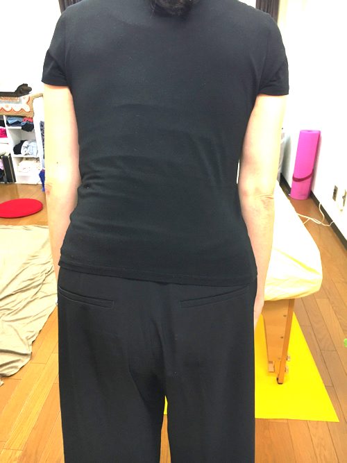 腰痛で歩けない-治療法5b