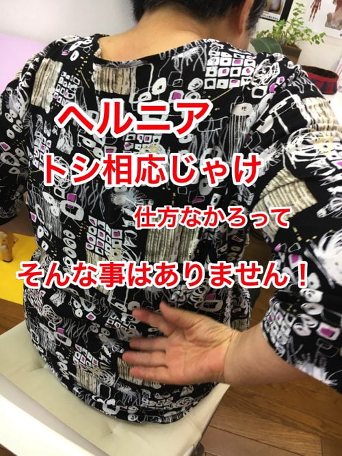 ヘルニアの治療と再発防止は足の指の曲がりを治す事も大切3-1