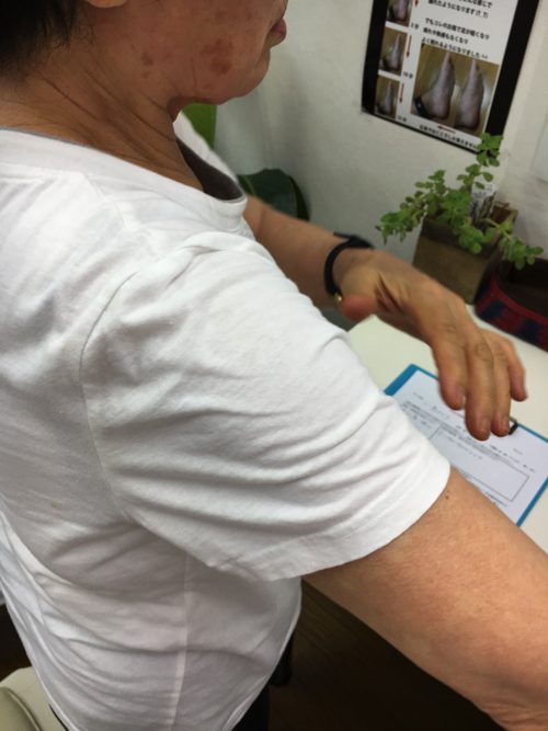 五十肩-腕を上げる際に肩が痛い-治し方2