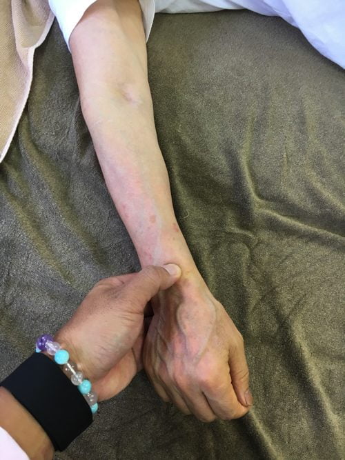 五十肩-腕を上げる際に肩が痛い-治し方5