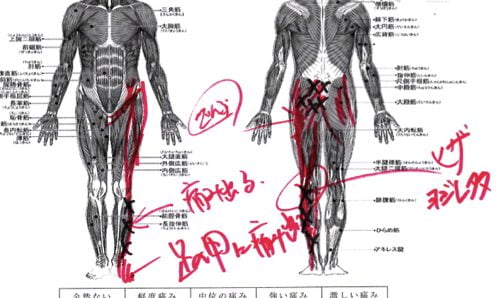 椎間板ヘルニア-腰の痛みと足のシビレを治す整体11