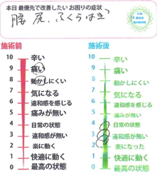 椎間板ヘルニア-腰の痛みと足のシビレを治す整体12