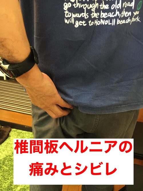 椎間板ヘルニア-腰の痛みと足のシビレを治す整体2