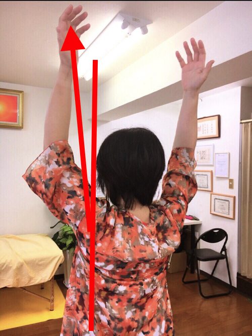 腕が痛くて上がらない四十肩の治し方2