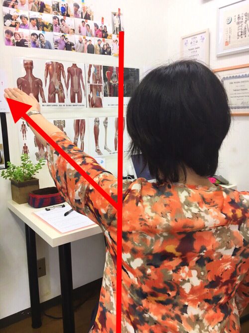 腕が痛くて上がらない四十肩の治し方3a