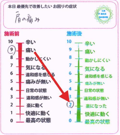 腕が痛くて上がらない四十肩の治し方5