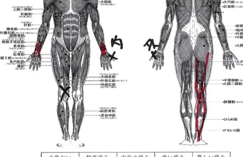 膝に水がたまり痛い-正座が出来ない-膝の治療方法6