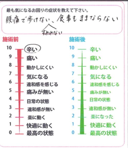 ぎっくり腰をすぐに治す-出張-ぎっくり腰治療7