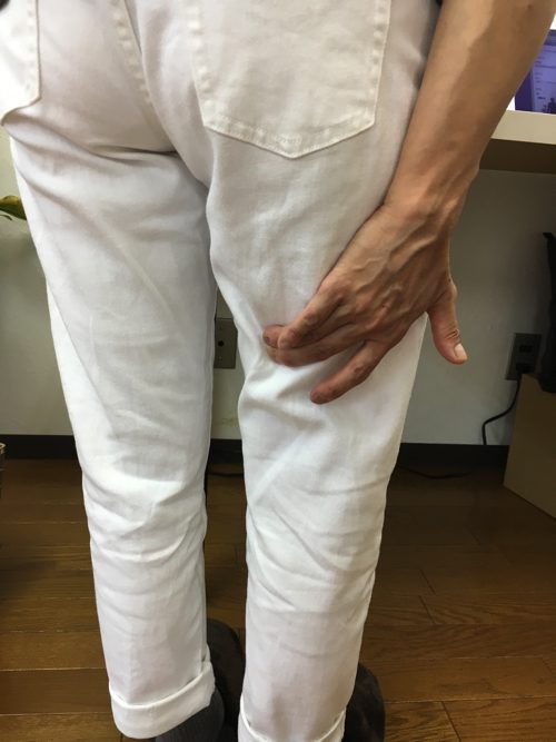 すべり症-腰の痛みと足のシビレの治療法2