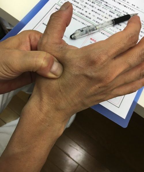 すべり症-腰の痛みと足のシビレの治療法4-e1502508498190