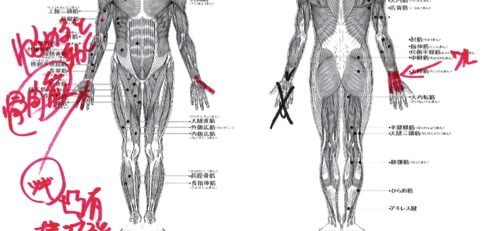 ばね指の原因と治療方法a7