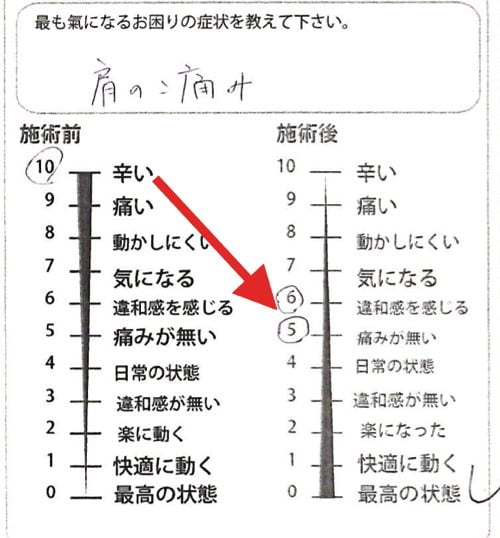 四十肩や五十肩で腕を上げる際に肩が痛い-治療7