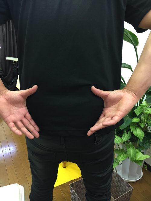 ぎっくり腰-治療-すぐに治る広島の腰痛専門整体院の実例1