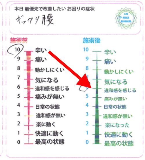 広島-ぎっくり腰-治療-すぐに治る5-1