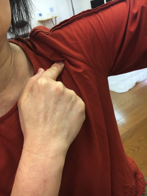 広島-四十肩・五十肩の治療で治ると有名な整体院の実例2