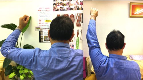 広島-四十肩・五十肩の治療で有名な整体院-治った例10