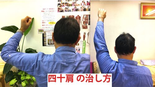 広島-四十肩・五十肩の治療で有名な整体院-治った例11