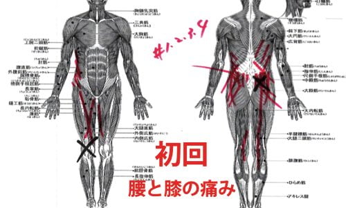 広島-椎間板ヘルニア治療-ヘルニアが治ると有名な整体院5