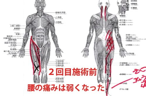 広島-椎間板ヘルニア治療-ヘルニアが治ると有名な整体院6