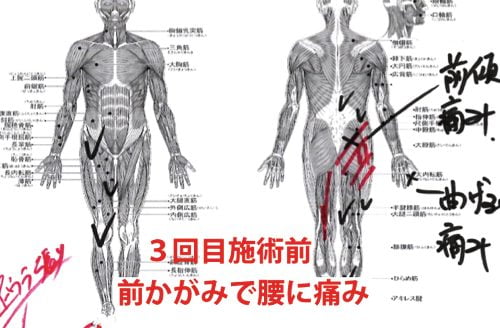 広島-椎間板ヘルニア治療-ヘルニアが治ると有名な整体院7