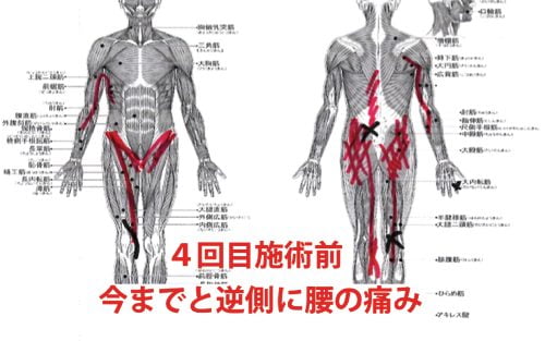 広島-椎間板ヘルニア治療-ヘルニアが治ると有名な整体院8