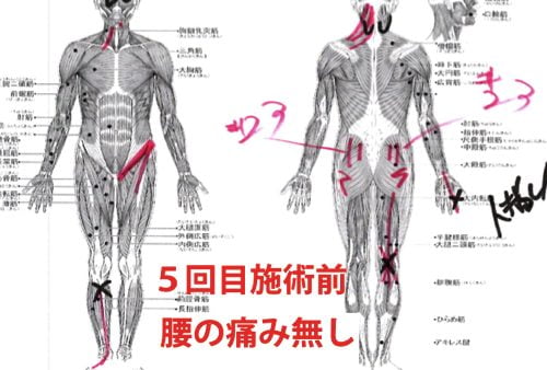 広島-椎間板ヘルニア治療-ヘルニアが治ると有名な整体院9