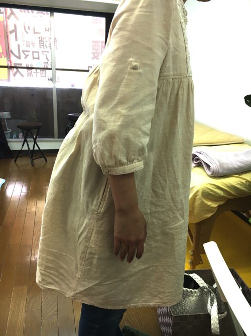 広島「ぎっくり腰」の治療で有名な整体院の治った例0926-3