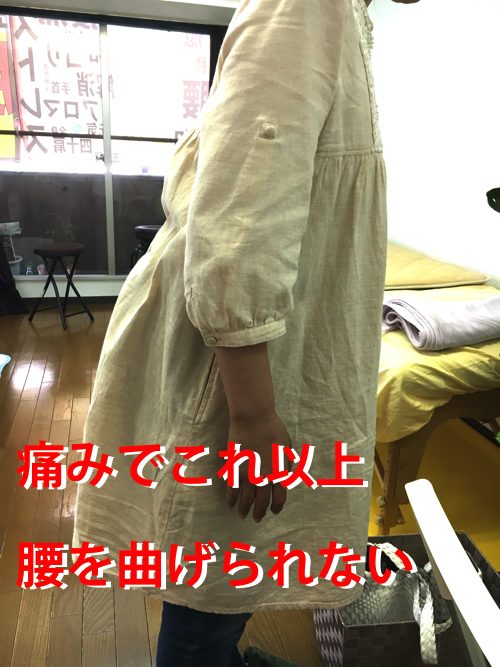 広島「ぎっくり腰」の治療で有名な整体院の治った例0926-3a
