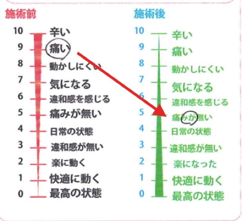 広島「ぎっくり腰」の治療で有名な整体院の治った例0926-5
