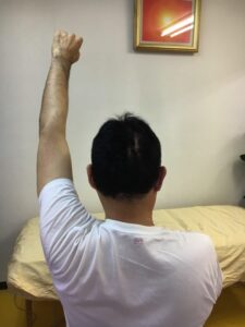 肩が上に上がらない、腕が回らない四十肩・五十肩等の肩の痛みの治療6