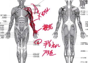 四十肩・五十肩等の肩の痛みの原因となる硬直した筋肉の図