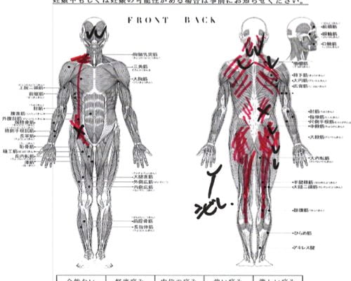 腰痛-ぎっくり腰の治療方法-広島で有名-腰痛専門整体院4