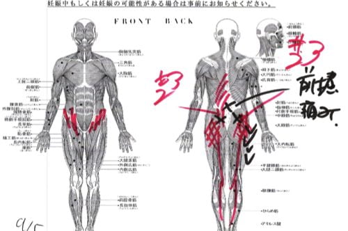 腰痛-椎間板ヘルニアの治療方法-広島で有名-腰痛専門整体院2