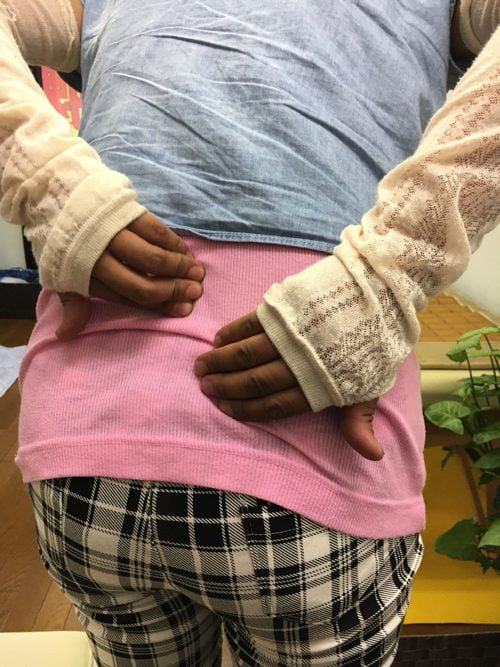 腰痛-椎間板ヘルニアの治療方法-広島で有名-腰痛専門整体院3