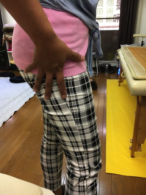 腰痛-椎間板ヘルニアの治療方法-広島で有名-腰痛専門整体院6