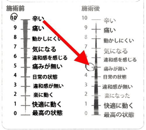 腰痛-椎間板ヘルニアの治療方法-広島で有名-腰痛専門整体院7