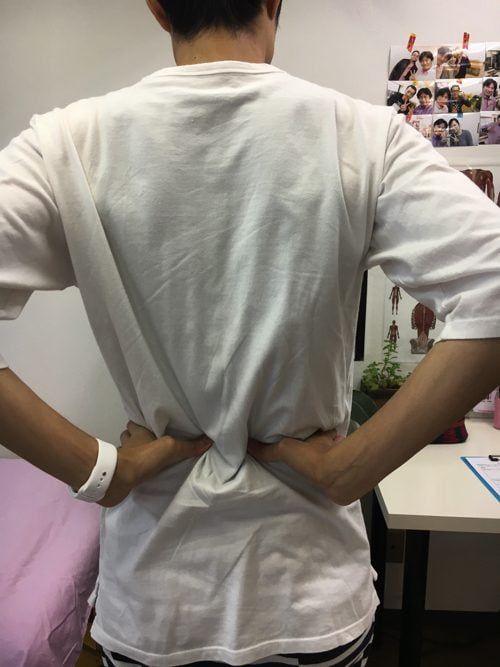 頭痛外来-偏頭痛と腰痛の治療-偏頭痛解消に効くヘッドマッサージ-広島1