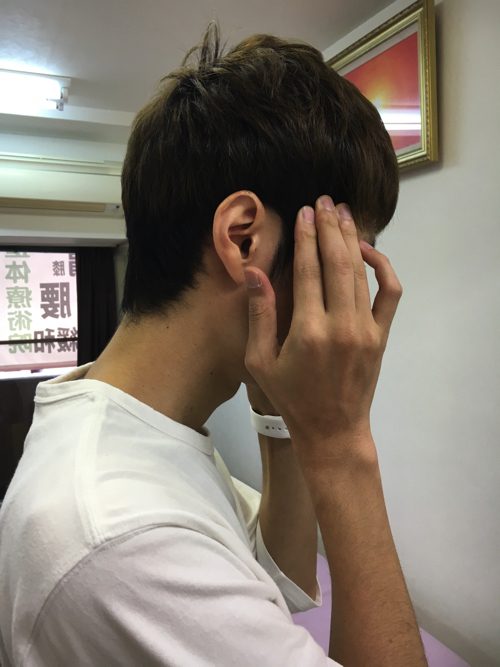 頭痛外来-偏頭痛と腰痛の治療-偏頭痛解消に効くヘッドマッサージ-広島2