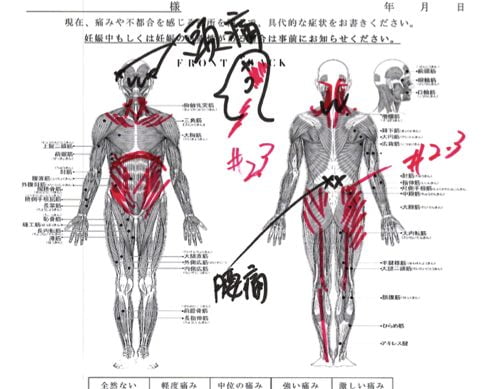 頭痛外来-偏頭痛と腰痛の治療-頭痛解消に効くヘッドマッサージ-広島1