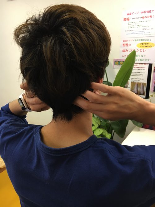 頭痛外来-頭痛治療-頭痛解消に効くヘッドマッサージ-広島1