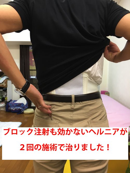 ブロック注射も効かない腰の痛み-ヘルニアの原因と治療法-広島の有名整体院1
