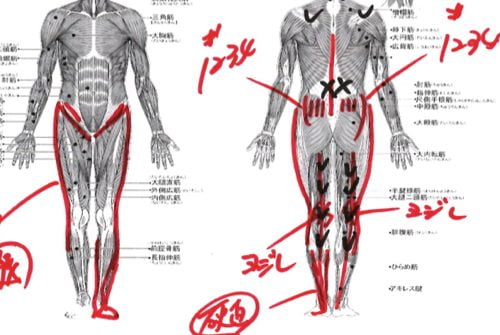 ヘルニアの治療と治し方-腰の痛み-脚の痺れ-膝に力が入らないー歩けない-原因11