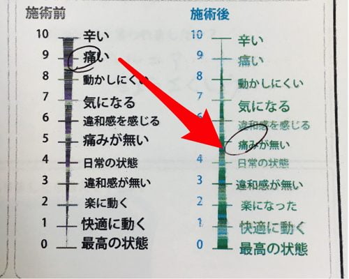 咳からくる腰痛の原因と治療方法-広島で腰痛専門の整体院の実例記録9