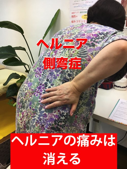 ヘルニアと側弯症で腰が痛く身体が傾く原因と治療方法