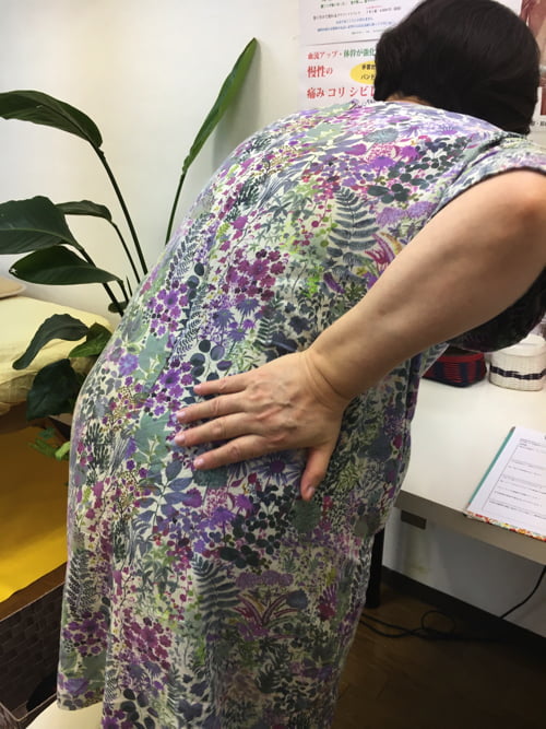 ヘルニアと側弯症で腰が痛く身体が傾く原因と治療方法