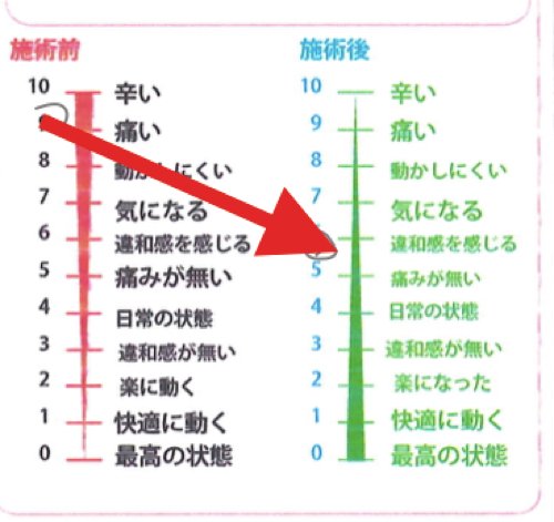 ヘルニアと側弯症で腰が痛く身体が傾く原因と治療方法