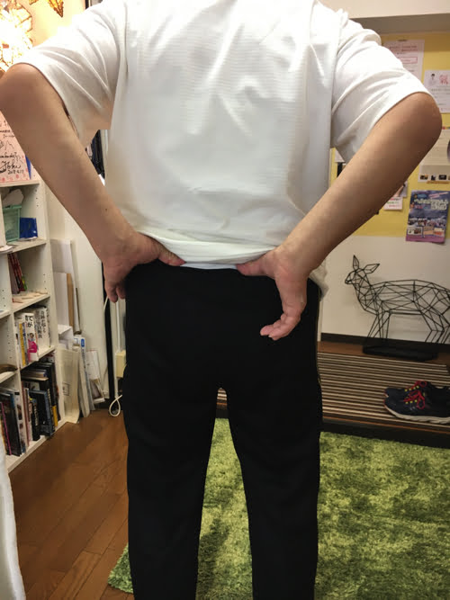 ヘルニアと診断され神経ブロックもリハビリも効果なかったが整体で治った例_広島