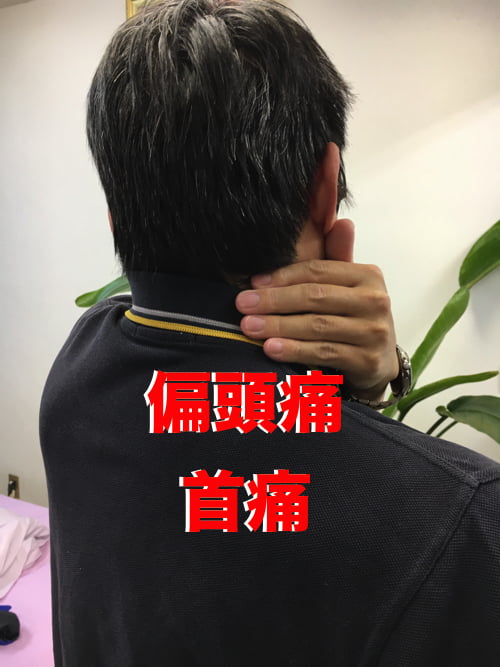 広島で偏頭痛の治療_肩から首と頭が痛い_薬を使わず治すヘッドマッサージ_ドライヘッドスパ